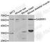 Gamma-Aminobutyric Acid Type A Receptor Rho1 Subunit antibody, A5745, ABclonal Technology, Western Blot image 