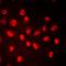 RB Transcriptional Corepressor 1 antibody, orb214499, Biorbyt, Immunofluorescence image 