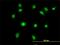 LIM Domain Binding 2 antibody, H00009079-M03, Novus Biologicals, Immunocytochemistry image 