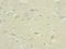 Tubulin Tyrosine Ligase Like 7 antibody, LS-C676656, Lifespan Biosciences, Immunohistochemistry paraffin image 