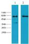 Keratin 6A antibody, A04012, Boster Biological Technology, Western Blot image 