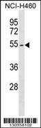 Erythropoietin receptor antibody, 58-645, ProSci, Western Blot image 