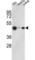 Histone Acetyltransferase 1 antibody, abx025916, Abbexa, Western Blot image 