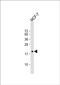 SEC11 Homolog A, Signal Peptidase Complex Subunit antibody, PA5-49273, Invitrogen Antibodies, Western Blot image 