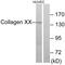 Collagen Type XX Alpha 1 Chain antibody, PA5-38895, Invitrogen Antibodies, Western Blot image 