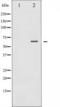 Spleen Associated Tyrosine Kinase antibody, TA325923, Origene, Western Blot image 