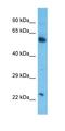 Chondroitin Sulfate N-Acetylgalactosaminyltransferase 2 antibody, orb325473, Biorbyt, Western Blot image 