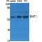 Solute Carrier Family 29 Member 1 (Augustine Blood Group) antibody, LS-C386805, Lifespan Biosciences, Western Blot image 