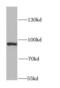DNA Methyltransferase 3 Alpha antibody, FNab02484, FineTest, Western Blot image 