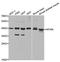 Hypoxia Inducible Factor 1 Subunit Alpha Inhibitor antibody, A5466, ABclonal Technology, Western Blot image 
