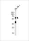 Delta Like Canonical Notch Ligand 3 antibody, LS-B10548, Lifespan Biosciences, Western Blot image 