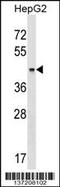 Keratin 23 antibody, 59-125, ProSci, Western Blot image 