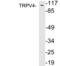 Transient Receptor Potential Cation Channel Subfamily V Member 4 antibody, LS-C743354, Lifespan Biosciences, Western Blot image 