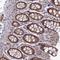 TGF-Beta Activated Kinase 1 (MAP3K7) Binding Protein 1 antibody, NBP2-38458, Novus Biologicals, Immunohistochemistry frozen image 