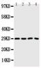 Carbonic Anhydrase 3 antibody, PA5-78898, Invitrogen Antibodies, Western Blot image 