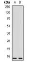 Cystatin F antibody, abx225127, Abbexa, Western Blot image 