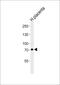 Calpain 6 antibody, MA5-24733, Invitrogen Antibodies, Western Blot image 