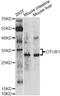 OTU Deubiquitinase, Ubiquitin Aldehyde Binding 1 antibody, A10313, ABclonal Technology, Western Blot image 