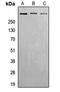 ATM Serine/Threonine Kinase antibody, GTX32295, GeneTex, Western Blot image 