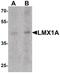 LIM Homeobox Transcription Factor 1 Alpha antibody, PA5-34470, Invitrogen Antibodies, Western Blot image 