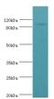 Adaptor Related Protein Complex 2 Subunit Beta 1 antibody, LS-C375219, Lifespan Biosciences, Western Blot image 