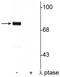Synapsin I antibody, P03794-3, Boster Biological Technology, Western Blot image 