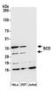 Scd antibody, A305-244A, Bethyl Labs, Western Blot image 