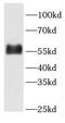 Fetuin B antibody, FNab03082, FineTest, Western Blot image 