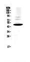 RANTES-R antibody, A01896-1, Boster Biological Technology, Western Blot image 