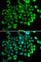 Apolipoprotein B MRNA Editing Enzyme Catalytic Subunit 3C antibody, STJ28150, St John