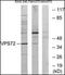 Vacuolar Protein Sorting 72 Homolog antibody, orb96519, Biorbyt, Western Blot image 