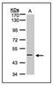 TNF Receptor Superfamily Member 25 antibody, AP23609PU-N, Origene, Western Blot image 