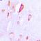 Ribosomal Protein S6 Kinase A1 antibody, orb214536, Biorbyt, Immunohistochemistry paraffin image 