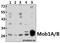 MOB Kinase Activator 1B antibody, A09405-1, Boster Biological Technology, Western Blot image 