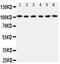 Minichromosome Maintenance Complex Component 2 antibody, PA5-79645, Invitrogen Antibodies, Western Blot image 