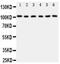 Minichromosome Maintenance Complex Component 2 antibody, PA5-79645, Invitrogen Antibodies, Western Blot image 