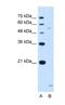 ST3 Beta-Galactoside Alpha-2,3-Sialyltransferase 5 antibody, NBP1-62444, Novus Biologicals, Western Blot image 