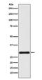 Charged Multivesicular Body Protein 3 antibody, M04800, Boster Biological Technology, Western Blot image 