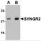 Synaptogyrin 2 antibody, MBS151187, MyBioSource, Western Blot image 