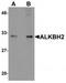 AlkB Homolog 2, Alpha-Ketoglutarate Dependent Dioxygenase antibody, TA320088, Origene, Western Blot image 