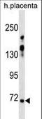 Zinc Finger Protein 251 antibody, LS-C157429, Lifespan Biosciences, Western Blot image 