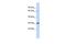 FcERI antibody, GTX46569, GeneTex, Western Blot image 