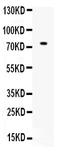 Zinc Finger And BTB Domain Containing 7A antibody, PB9910, Boster Biological Technology, Western Blot image 