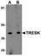 Potassium Two Pore Domain Channel Subfamily K Member 18 antibody, LS-B5066, Lifespan Biosciences, Western Blot image 