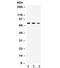 Cytochrome P450 Family 11 Subfamily A Member 1 antibody, R32409, NSJ Bioreagents, Western Blot image 