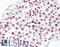 Enhancer Of Polycomb Homolog 1 antibody, LS-B9739, Lifespan Biosciences, Immunohistochemistry paraffin image 