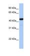 Galactose-3-O-Sulfotransferase 3 antibody, orb325554, Biorbyt, Western Blot image 