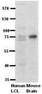 Phosphofructokinase, Liver Type antibody, TA338906, Origene, Western Blot image 