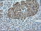 Alpha-1-antitrypsin antibody, GTX83663, GeneTex, Immunohistochemistry paraffin image 