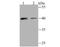 Bone Marrow Stromal Cell Antigen 2 antibody, NBP2-75423, Novus Biologicals, Western Blot image 